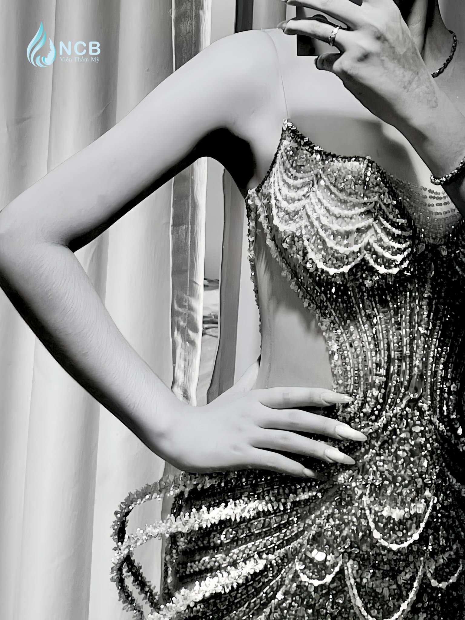 hút mỡ bắp tay cùng bé năm