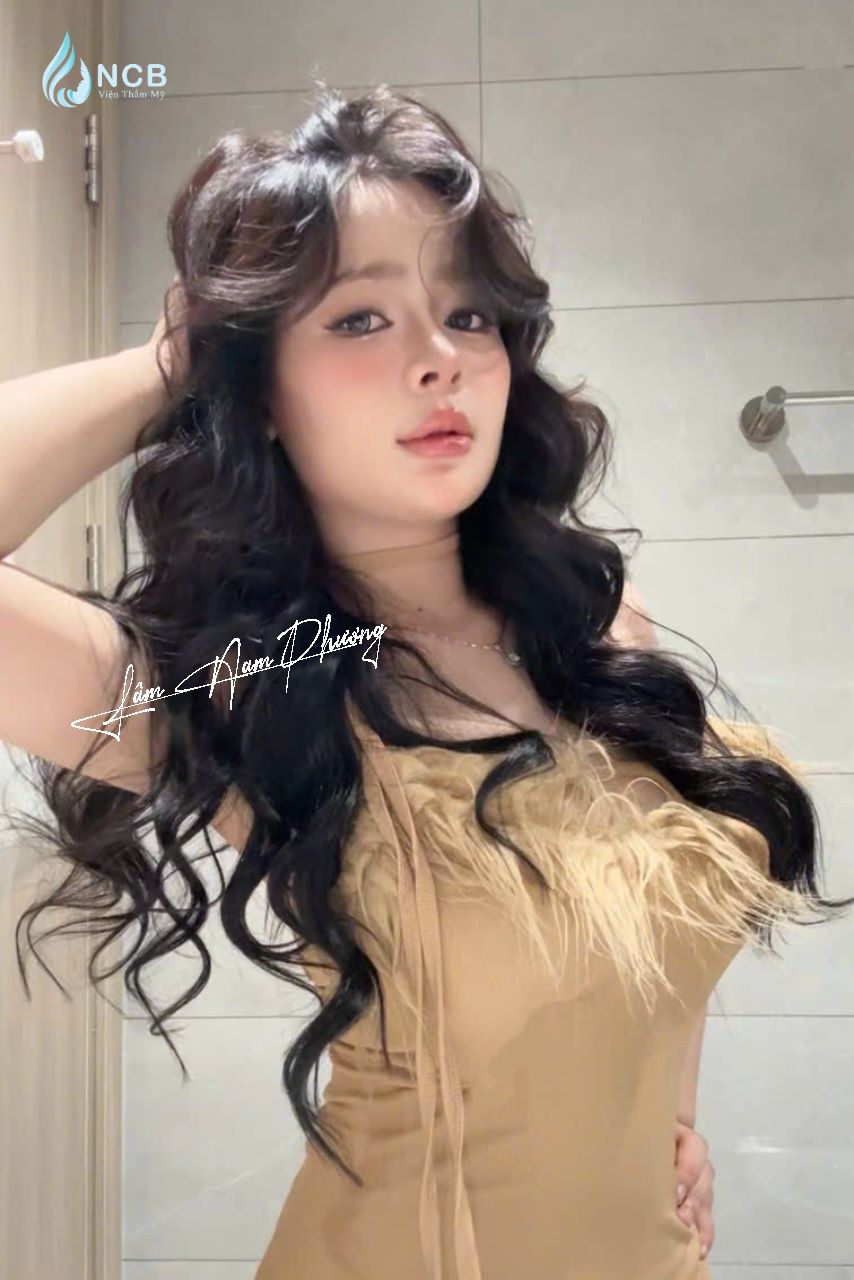 Lâm Nam Phương nâng mũi