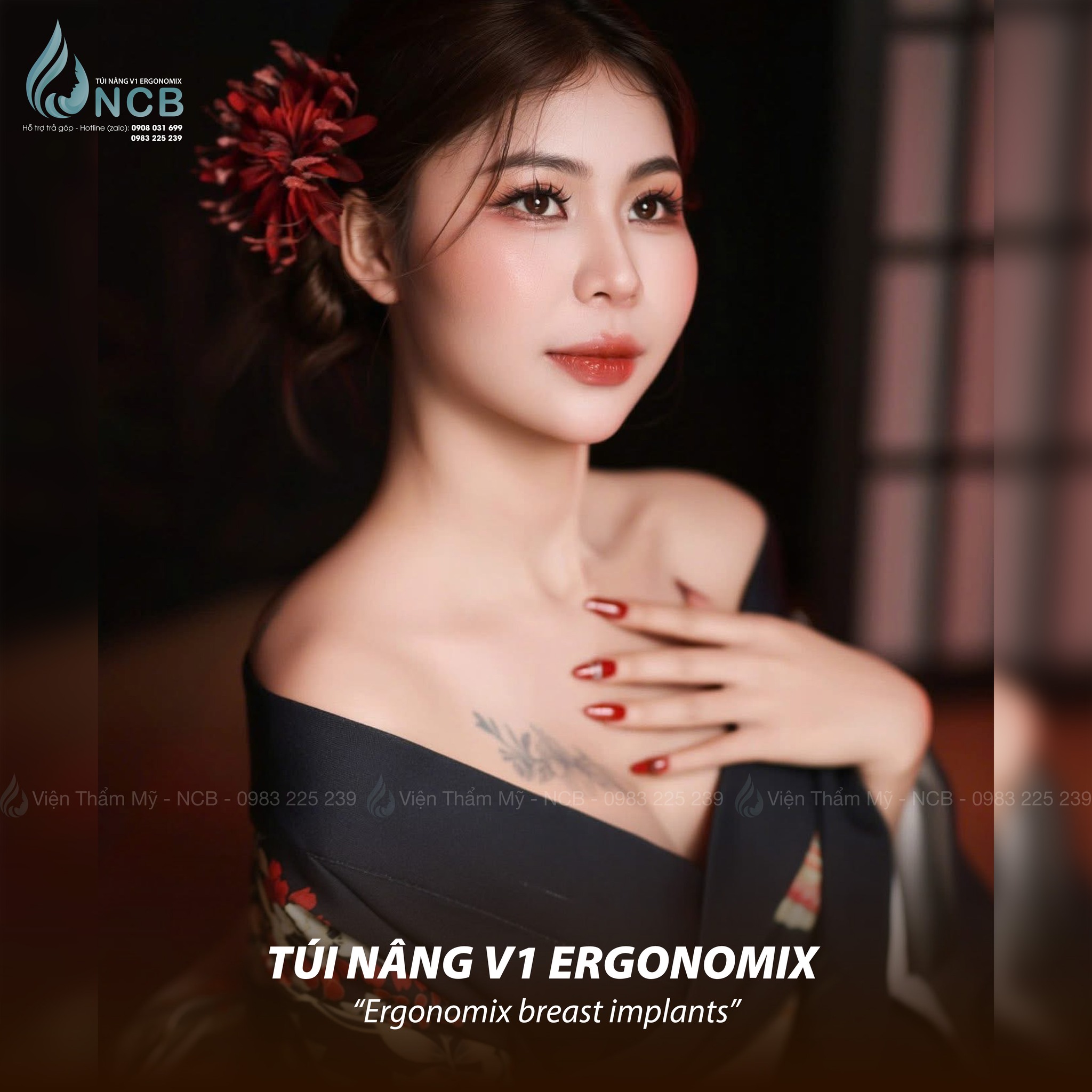 túi ngực motiva ergonomix 2