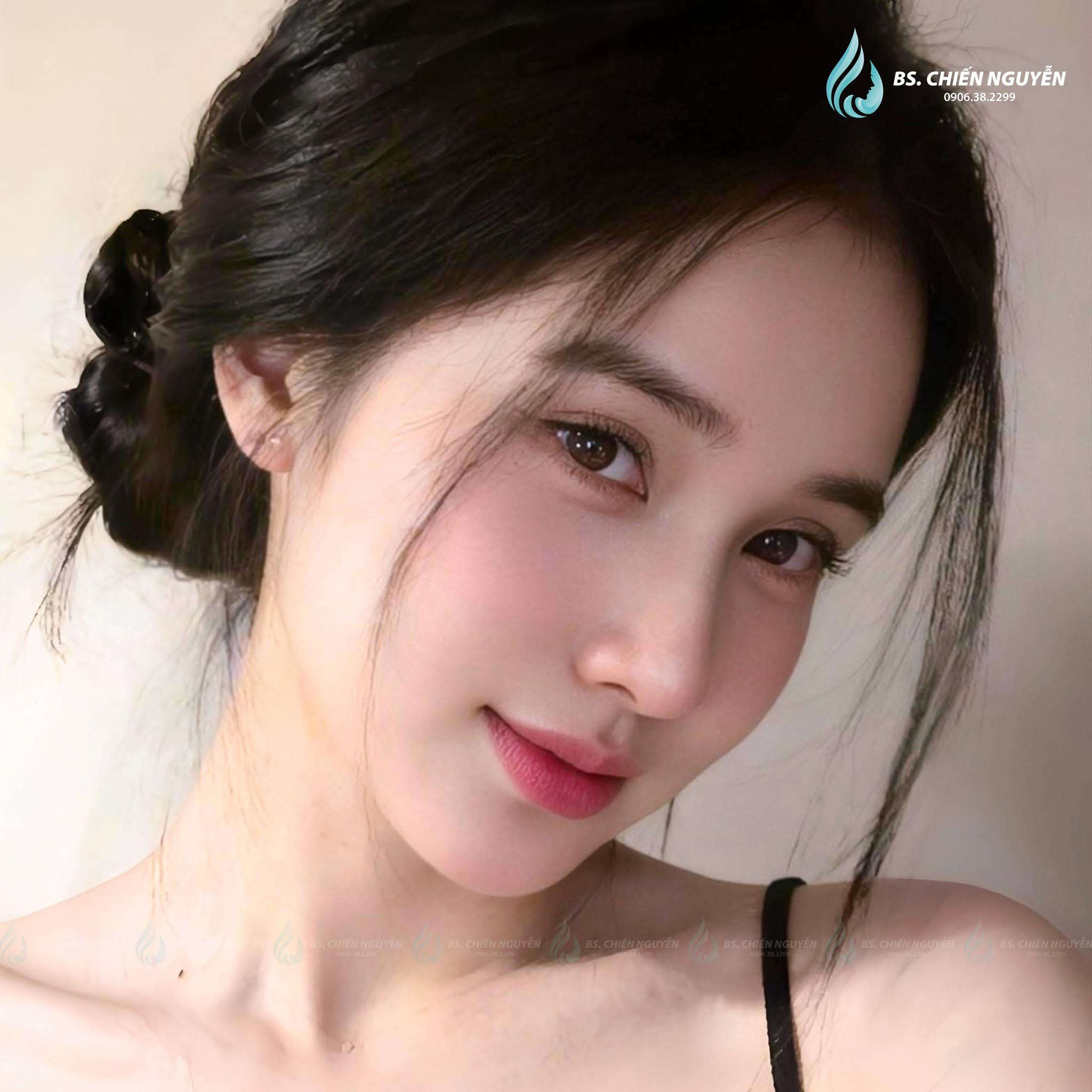 Nâng Mũi Tỷ Tỷ Douyin