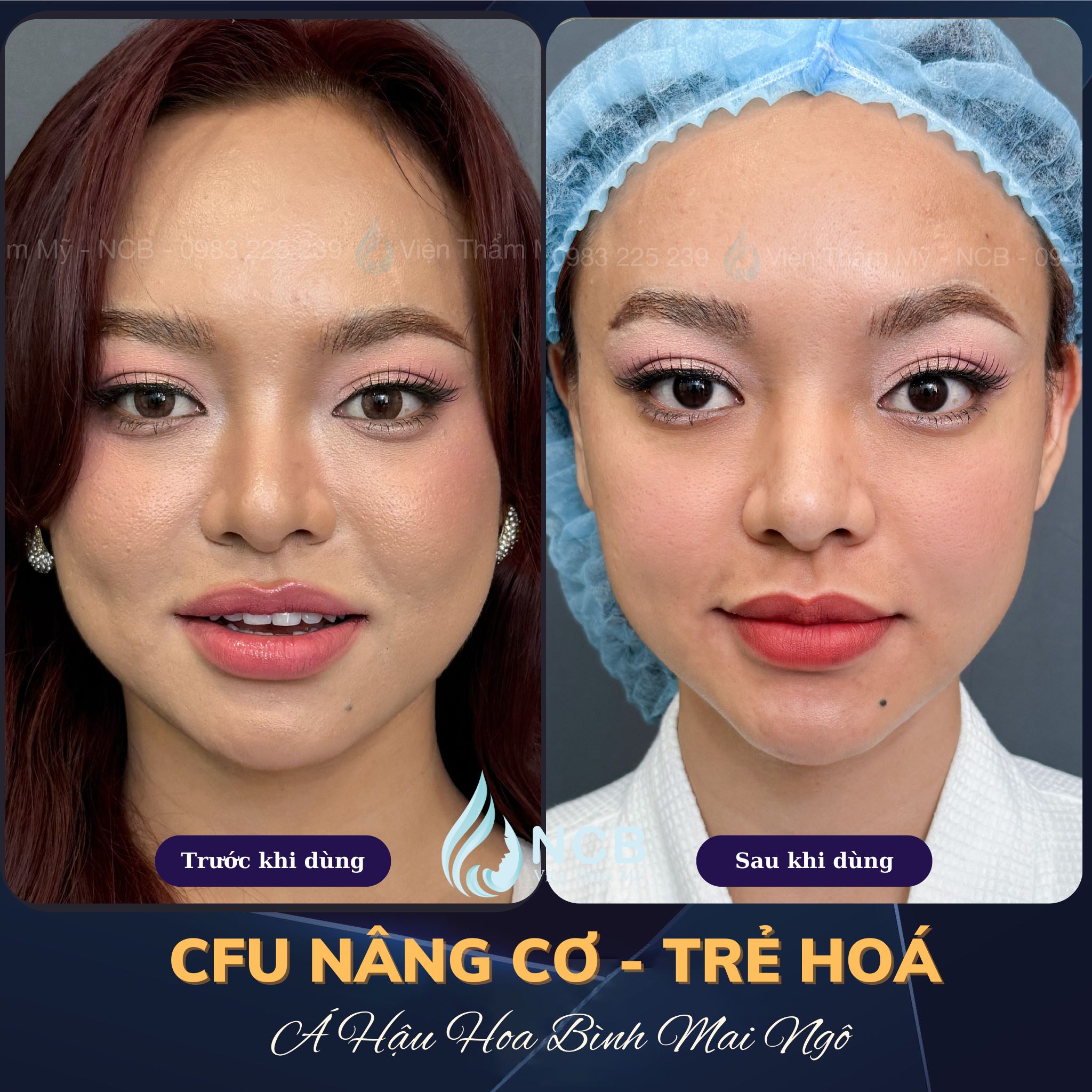 tạo viền hàm vline bằng cfu-èlife