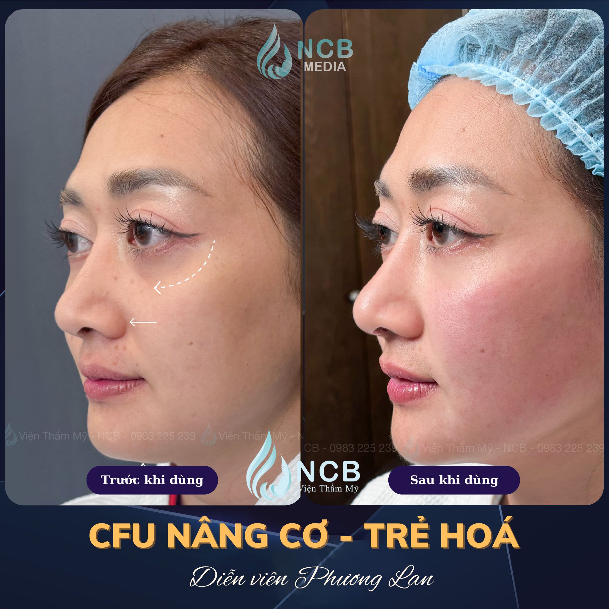 tạo viền hàm vline bằng cfu-èlife