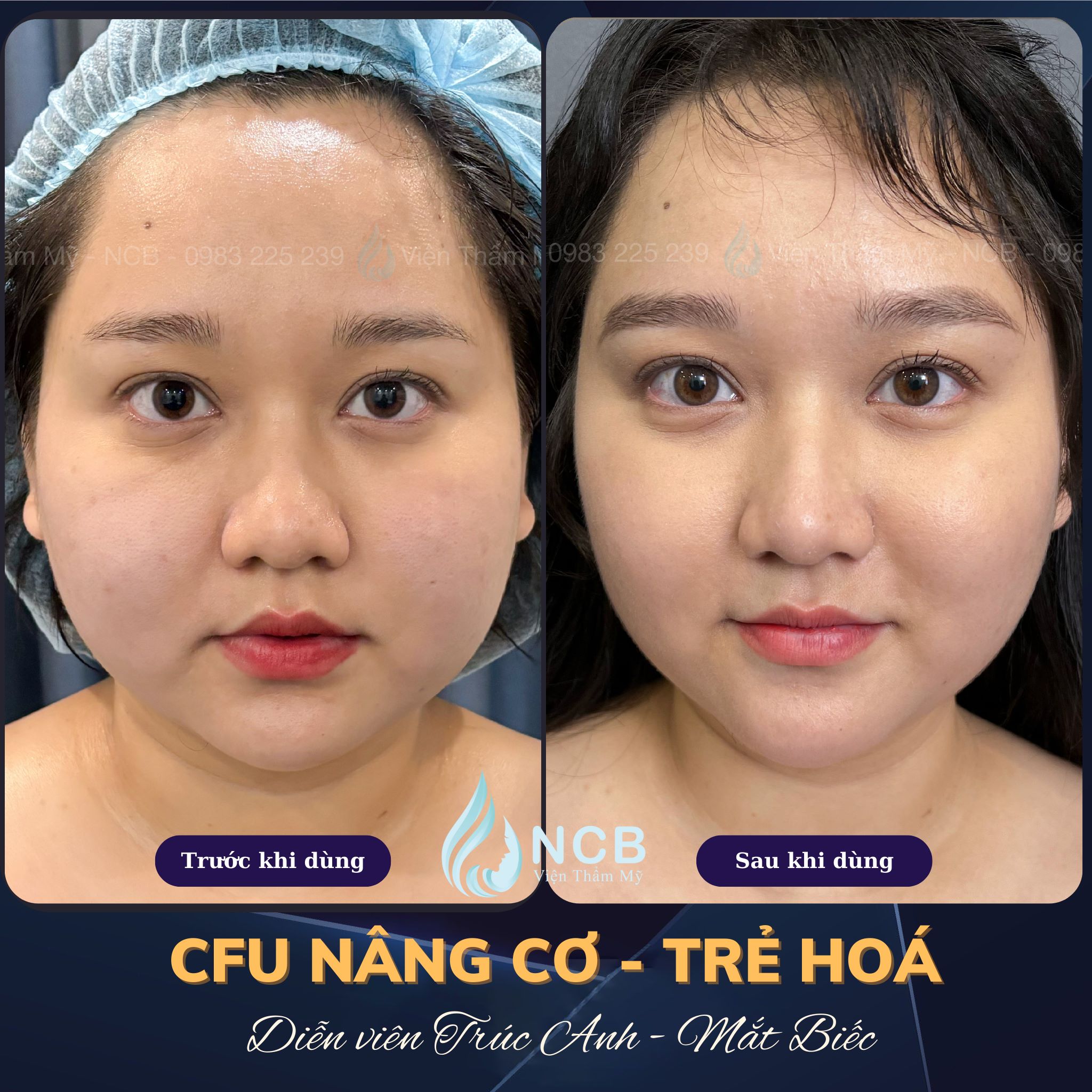 tạo viền hàm vline bằng cfu-èlife