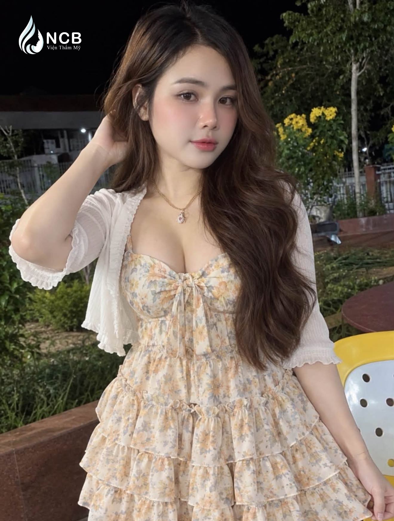hương cà khịa sau nâng mũi + độn cằm